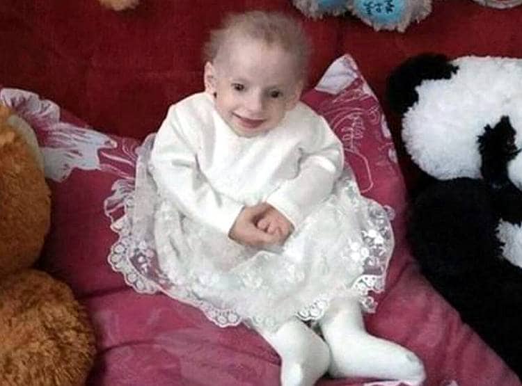 8 साल की बच्ची बूढ़ी होकर मर गई...ये कैसी बीमारी?