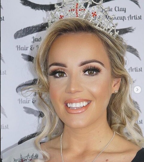 मंगेतर ने मोटी कहकर छोड़ा, लड़की ने खुद को बदलकर ऐसे लिया बदला