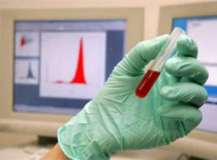 महिला का टेस्ट करते ही चौंके डॉक्टर, यूरीन की जगह बन रही शराब