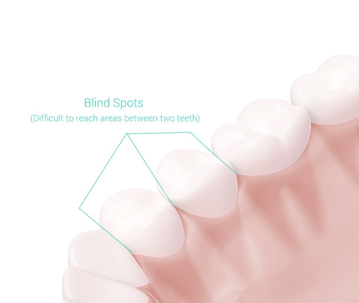 Xiaomi ने भारत में लॉन्च किया इलेक्ट्रिक टूथब्रश, जानें खासियत और कीमत