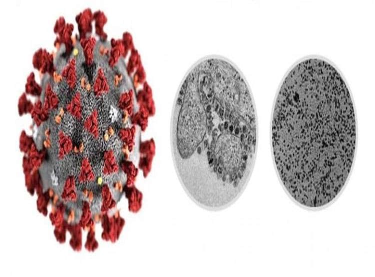 आपने देखी कोरोना वायरस की असली तस्वीर, माइक्रोमीटर का है 1000वां हिस्सा