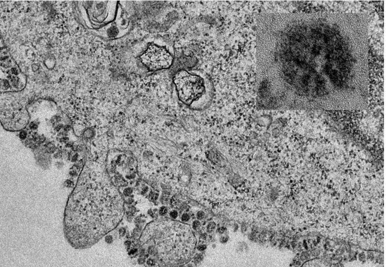 आपने देखी कोरोना वायरस की असली तस्वीर, माइक्रोमीटर का है 1000वां हिस्सा