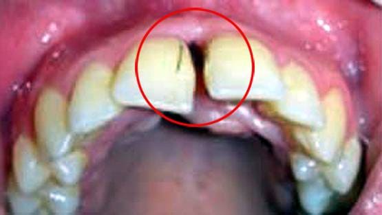 इस महिला के दांतों-मसूड़ों में उग रहे हैं बाल, डॉक्टर भी हैरान...