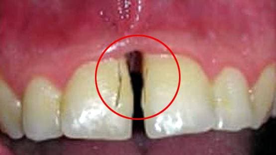 इस महिला के दांतों-मसूड़ों में उग रहे हैं बाल, डॉक्टर भी हैरान...
