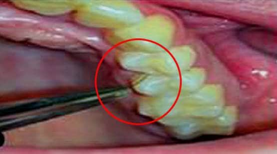 इस महिला के दांतों-मसूड़ों में उग रहे हैं बाल, डॉक्टर भी हैरान...