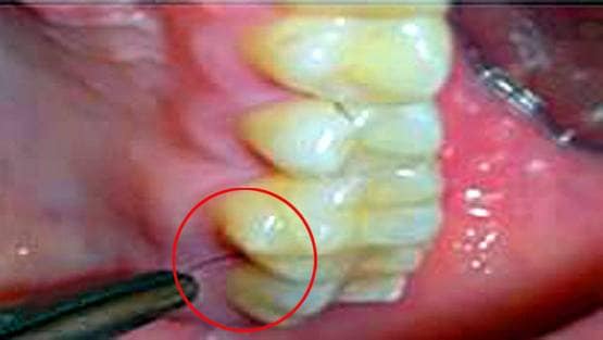 इस महिला के दांतों-मसूड़ों में उग रहे हैं बाल, डॉक्टर भी हैरान...