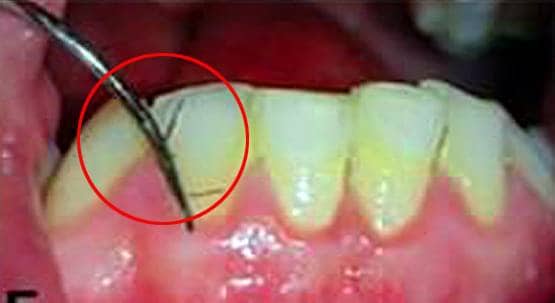 इस महिला के दांतों-मसूड़ों में उग रहे हैं बाल, डॉक्टर भी हैरान...