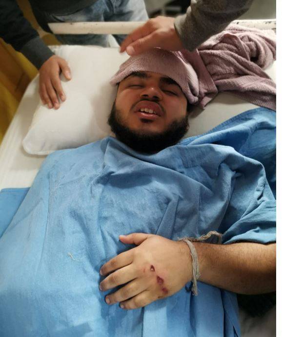 जामिया में फिर बवाल, CAA का विरोध कर रहे छात्रों पर बरसीं लाठियां, देखें तस्वीर