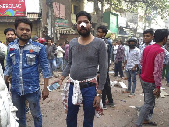 दिल्ली: CAA पर हिंसा की सबसे DISTURBING तस्वीरें