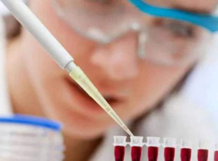 महिला का टेस्ट करते ही चौंके डॉक्टर, यूरीन की जगह बन रही शराब