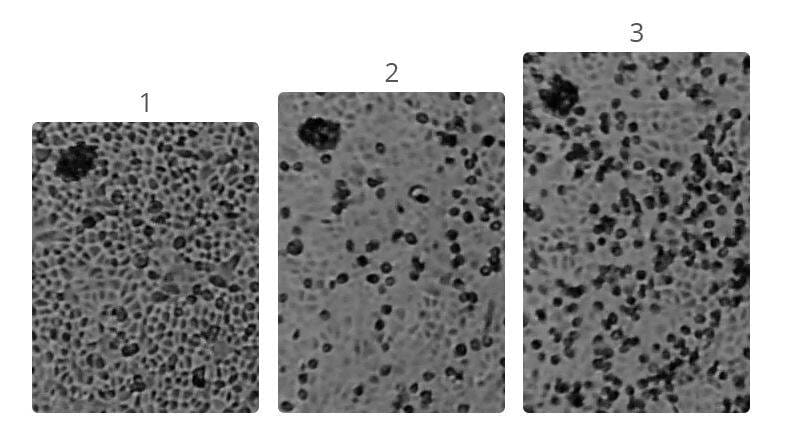 आपने देखी कोरोना वायरस की असली तस्वीर, माइक्रोमीटर का है 1000वां हिस्सा
