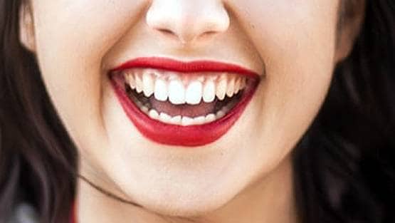 इस महिला के दांतों-मसूड़ों में उग रहे हैं बाल, डॉक्टर भी हैरान...