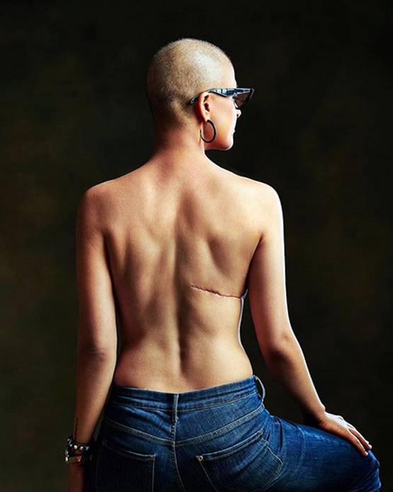 World Cancer Day: राजेश खन्ना से ऋषि कपूर तक, इन एक्टर्स ने लड़ी कैंसर से जंग