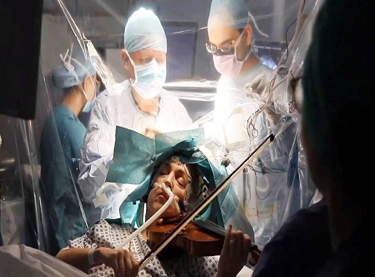 महिला बजाती रही वायलिन, डॉक्टरों ने सिर खोलकर निकाला ट्यूमर
