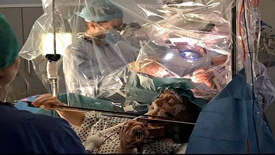 महिला बजाती रही वायलिन, डॉक्टरों ने सिर खोलकर निकाला ट्यूमर