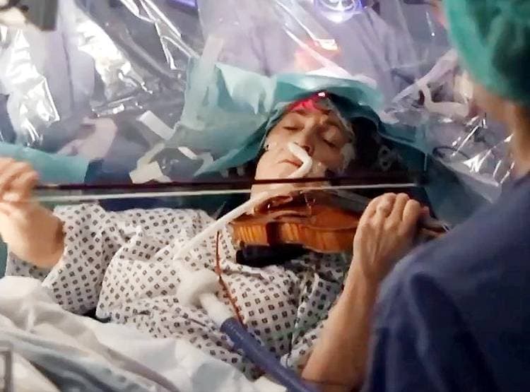 महिला बजाती रही वायलिन, डॉक्टरों ने सिर खोलकर निकाला ट्यूमर