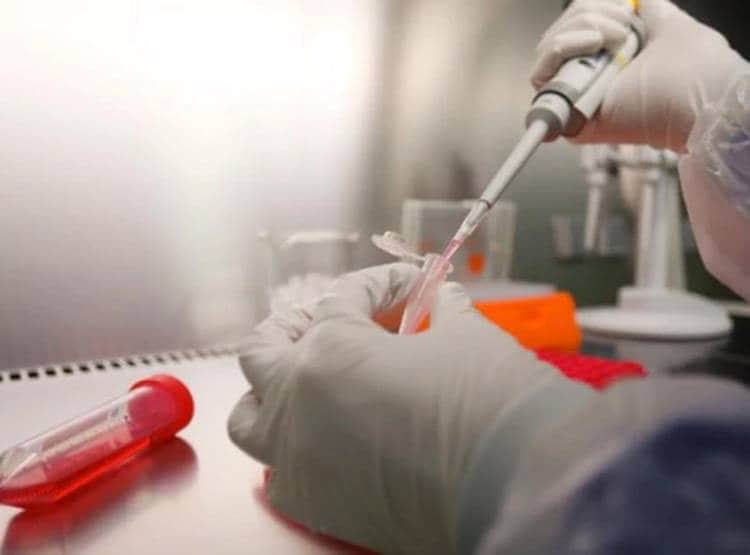 महिला का टेस्ट करते ही चौंके डॉक्टर, यूरीन की जगह बन रही शराब