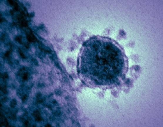 कोरोना वायरस: भारत में कम टेस्ट को लेकर विदेशी मीडिया में क्यों उठ रहे सवाल?