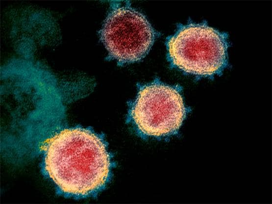 कोरोना से कैसे बचें? इन वस्तुओं पर इतने घंटे तक रहता है वायरस