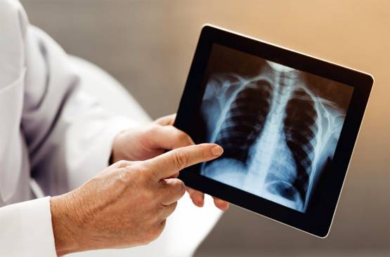 शरीर पर कब और कैसे हमला करता है कोरोना? तेजी से फैलने का कारण भी जानें