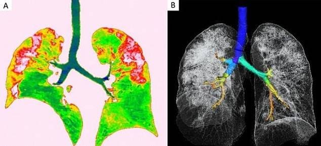 5 दिन में दिखें ये 3 लक्षण, तो जरूर करवा लें कोरोना वायरस की जांच