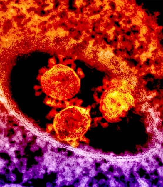 कोरोना से कैसे बचें? इन वस्तुओं पर इतने घंटे तक रहता है वायरस