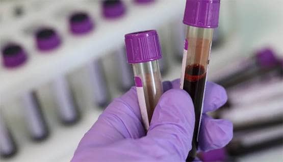 चीन के डॉक्टरों का दावा- कोरोना से बचाने में कारगर है जापानी दवा