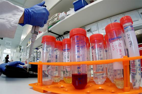 कोरोना से कैसे बचें? इन वस्तुओं पर इतने घंटे तक रहता है वायरस