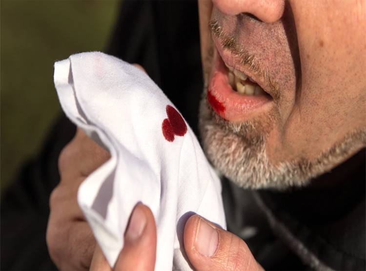 कोरोना के बाद फैली रहस्यमयी बीमारी, मुंह-नाक से आता है खून