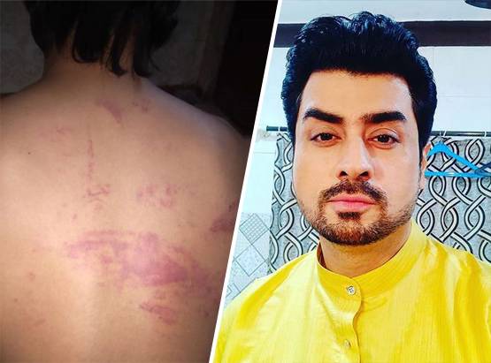 लड़की से छेड़छाड़ देख सहमे प्रीतम, रेस्क्यू करने पर खाए मुक्के, कार डैमेज