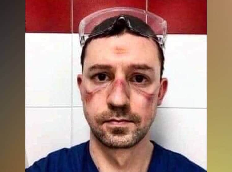 चेहरे पर लगे मास्क हटे तो रह गए निशान, PAK सांसद ने शेयर किए फोटो