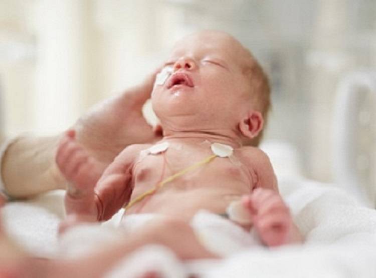 पैदा होते ही हुआ कोरोना वायरस, डॉक्टर्स ने नवजात को किया ठीक