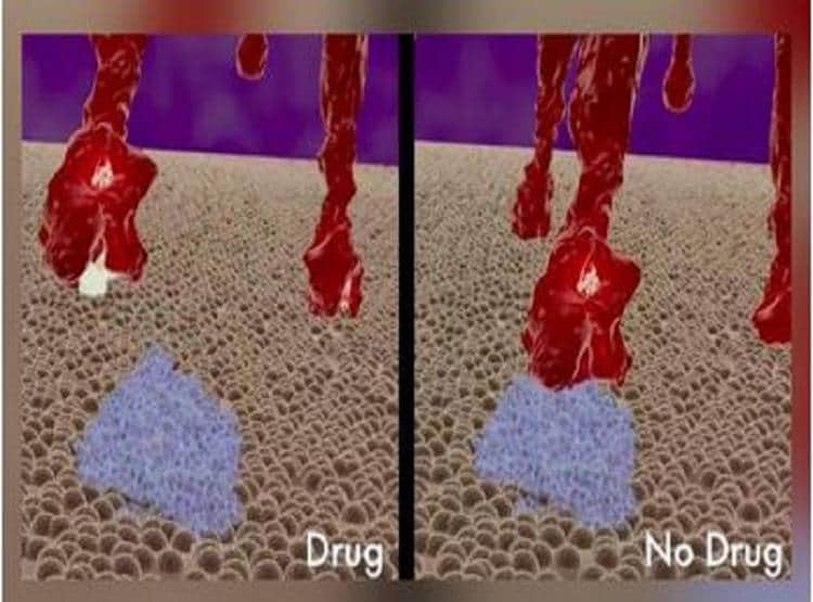 US के सुपर कंप्यूटर ने खोजा कोरोना का इलाज, बन सकता है वैक्सीन