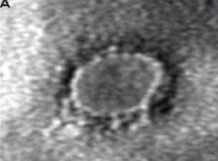 भारत के वैज्ञानिकों ने की कोरोना वायरस की पहचान, तस्वीर जारी