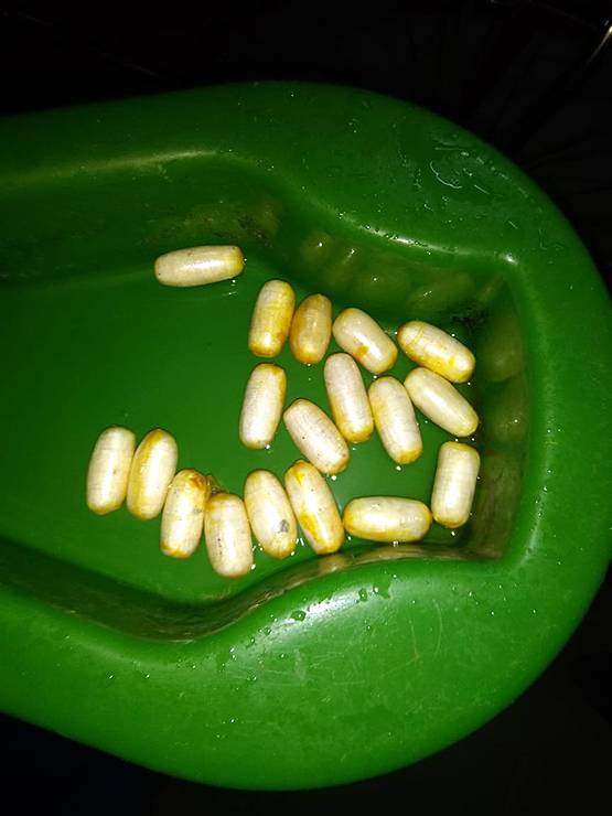 13 कंडोम में भरकर गुप्तांग में छुपा रखी थी कोकेन, तस्कर गिरफ्तार