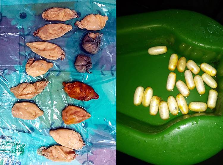 13 कंडोम में भरकर गुप्तांग में छुपा रखी थी कोकेन, तस्कर गिरफ्तार