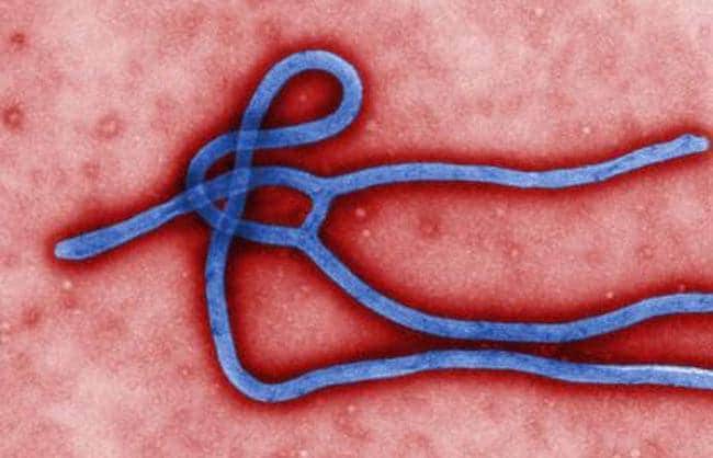 इबोला, जीका या कोरोना, ऐसी महामारी से गरीब देश हो जाता है कंगाल!