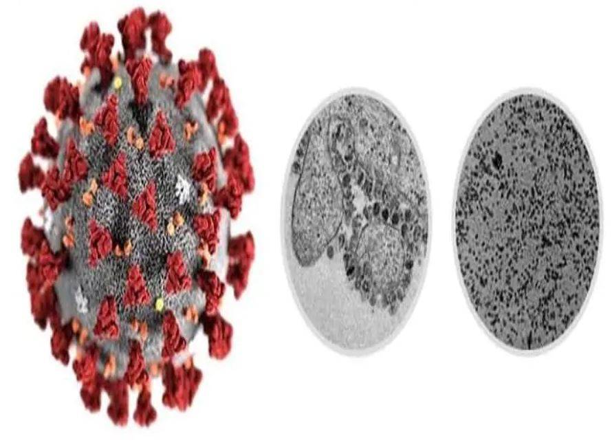 अब सिर्फ 45 मिनट में कोरोना की पहचान, इस देश को मिली कामयाबी