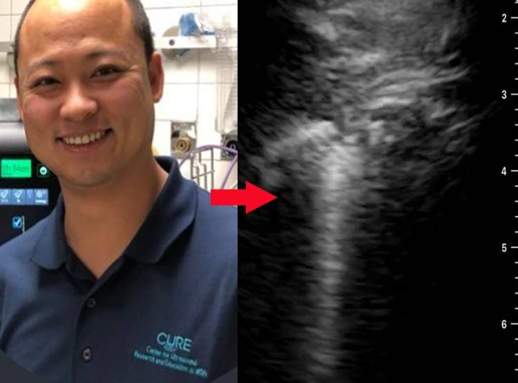 कोरोना मरीज की आपबीती, बताया कैसे शरीर में हमला करता है वायरस