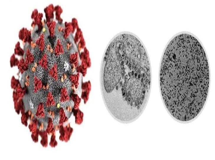 नॉर्थ कोरिया में मिला कोरोना का पहला मरीज, किम जोंग ने दिया गोली मारने का आदेश