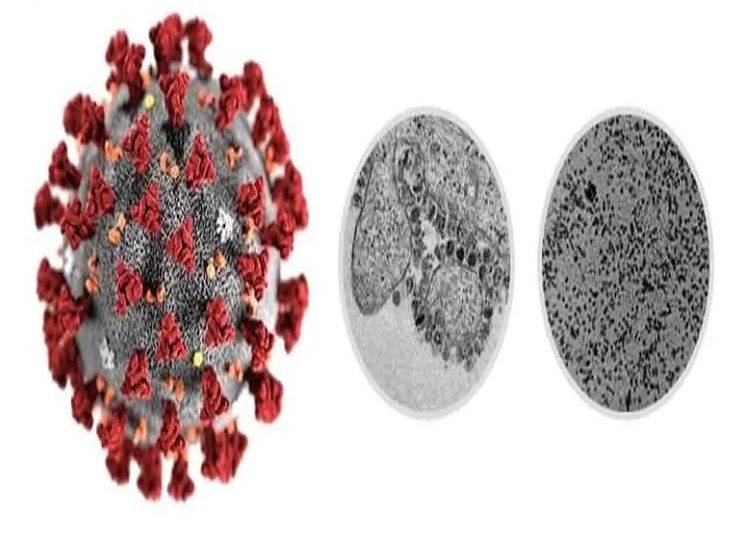 क्या गोमूत्र और गोबर खाने से ठीक हो सकता है कोरोना वायरस?