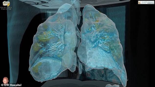 कुछ ही दिनों में फेफड़ों को कैसे बर्बाद कर देता है कोरोना, देखें तस्वीरें