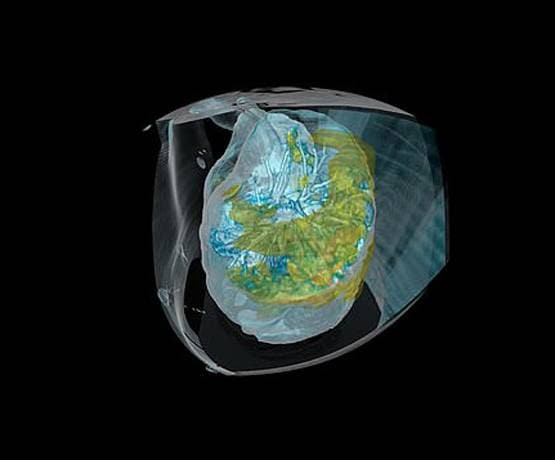 कुछ ही दिनों में फेफड़ों को कैसे बर्बाद कर देता है कोरोना, देखें तस्वीरें