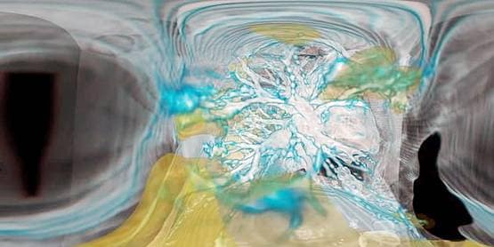 कुछ ही दिनों में फेफड़ों को कैसे बर्बाद कर देता है कोरोना, देखें तस्वीरें