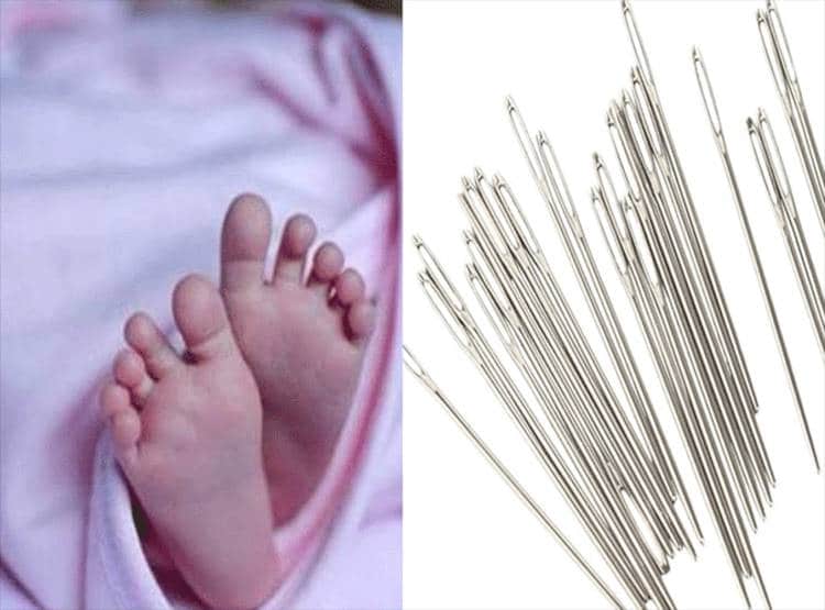 दर्द से तड़प रहा था बच्चा, X Ray देख चौंके डॉक्टर, गुप्तांग से निकलीं 11 सुइयां