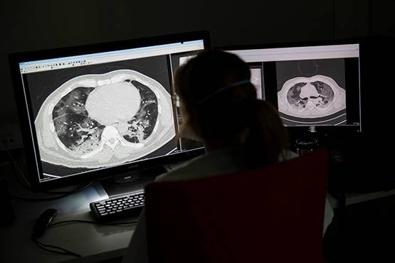 कुछ ही दिनों में फेफड़ों को कैसे बर्बाद कर देता है कोरोना, देखें तस्वीरें