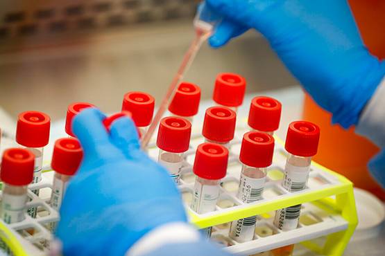 US: 3 बार आया मरीज, डॉक्टरों ने नहीं किया टेस्ट-कोरोना से मौत