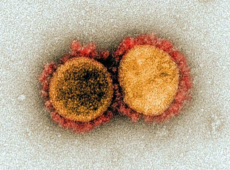 कोरोना वायरस ऐसे घुसता है शरीर में, समझिए इन 12 तस्वीरों में