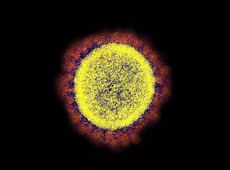 कोरोना वायरस के डरावने चेहरे, वैज्ञानिकों द्वारा ली गई तस्वीरें देखिए