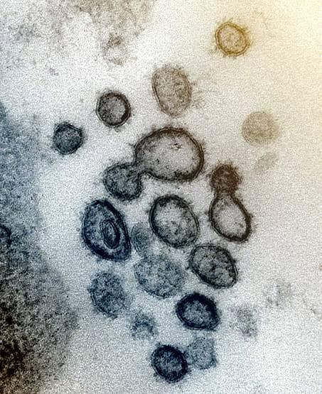 कोरोना वायरस के डरावने चेहरे, वैज्ञानिकों द्वारा ली गई तस्वीरें देखिए